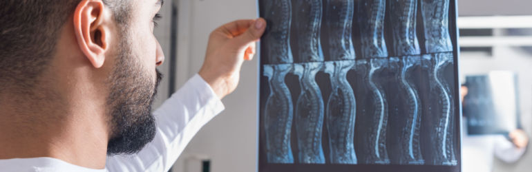 spinal cord